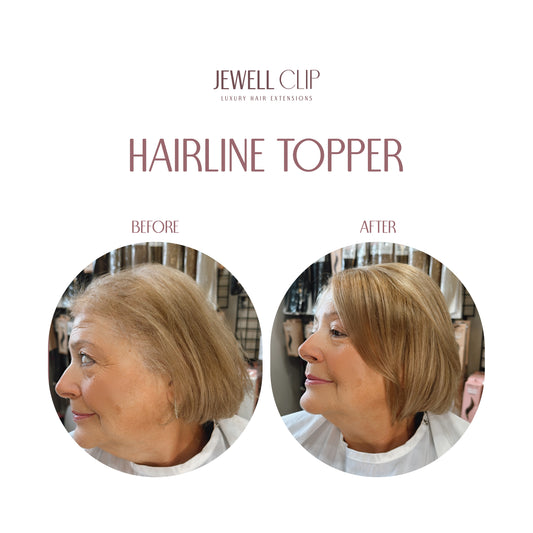 8” Hairline Topper