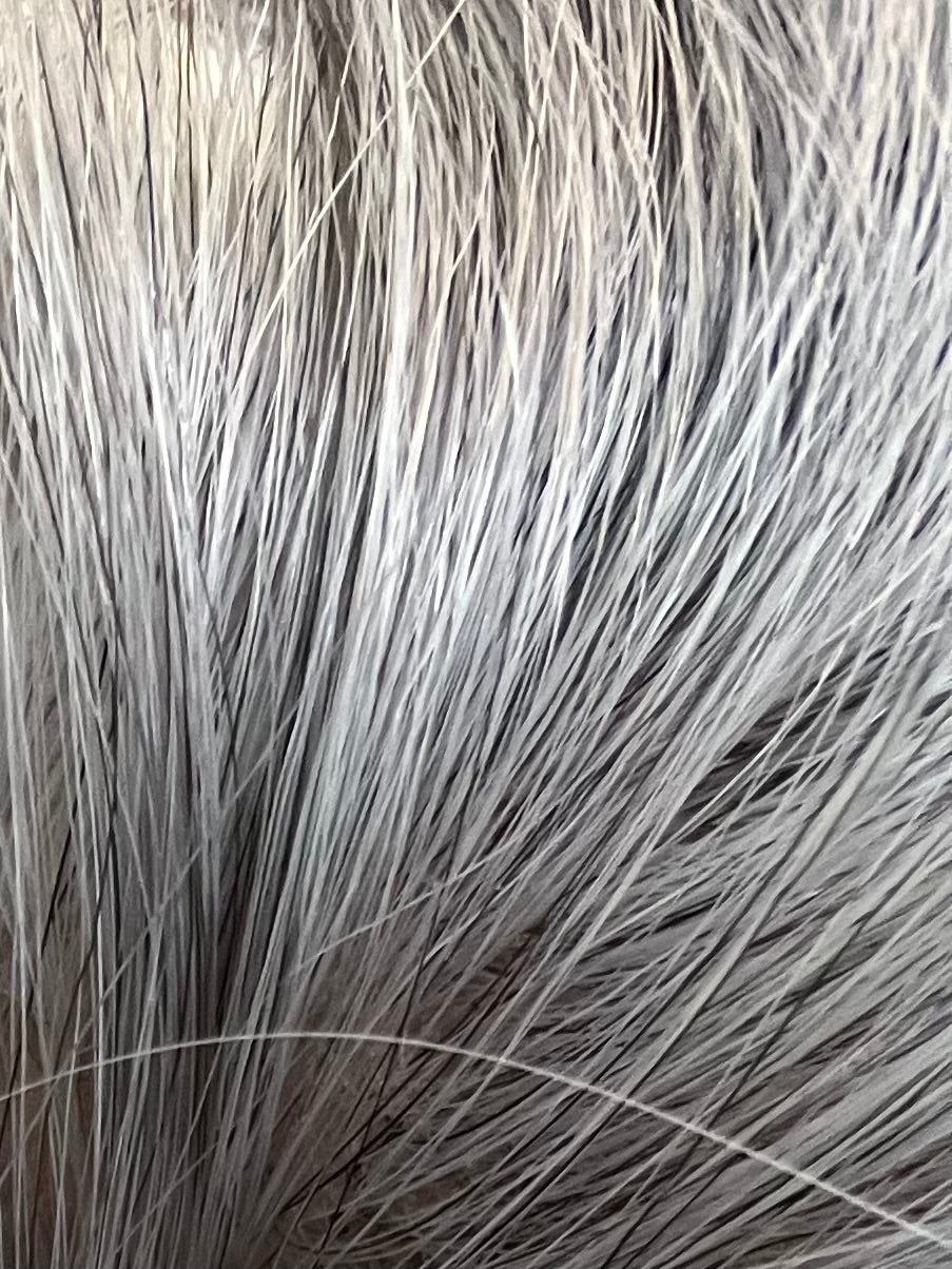 Hybrid Hairline Topper (Jewell Clip X Skye)
